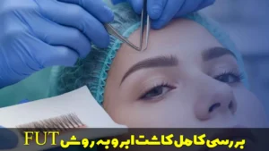 بررسی کامل کاشت ابرو به روش FUT