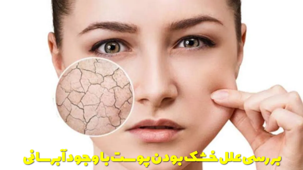 بررسی علل خشک بودن پوست با وجود آبرسانی