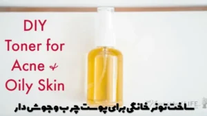 ساخت تونر خانگی برای پوست چرب و جوش دار