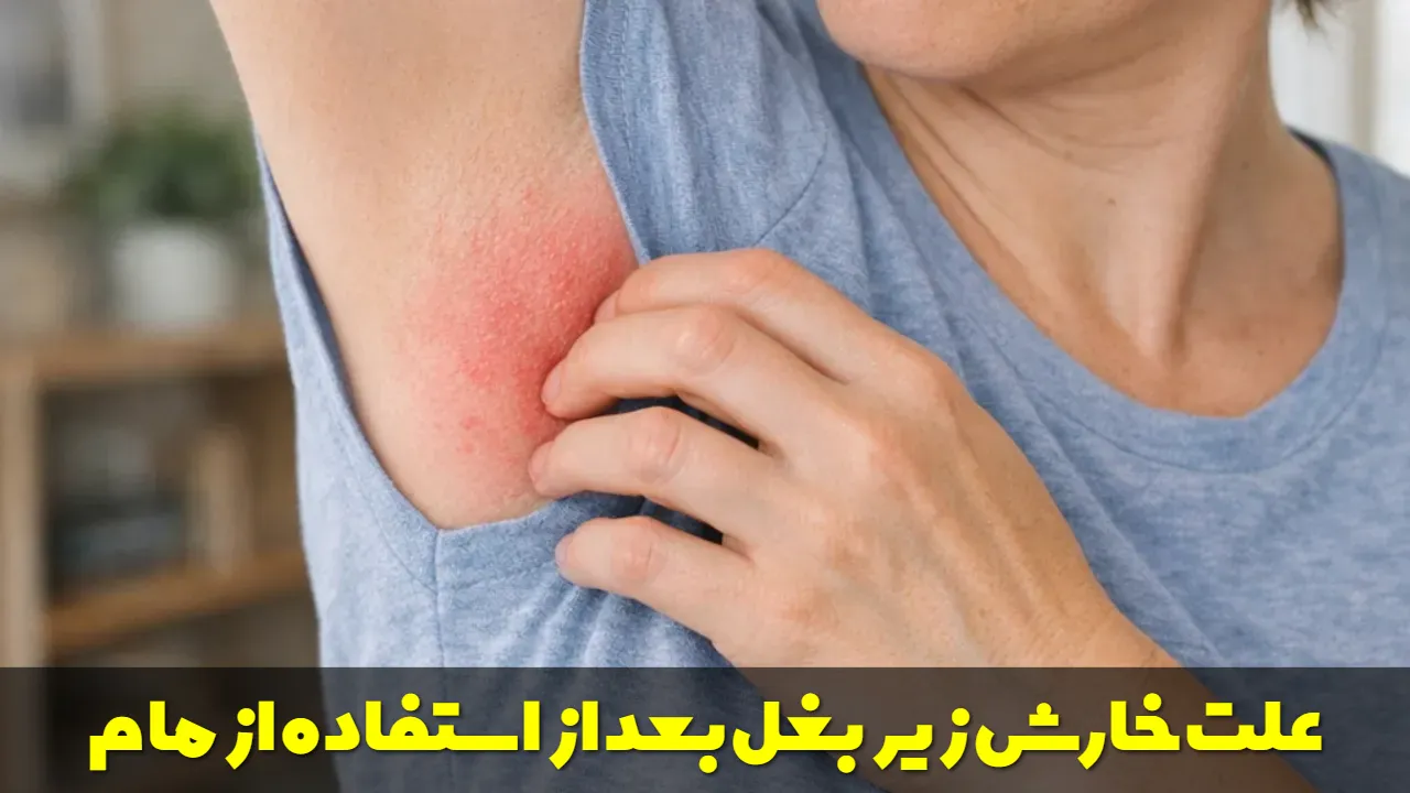 علت خارش زیر بغل بعد از استفاده از مام
