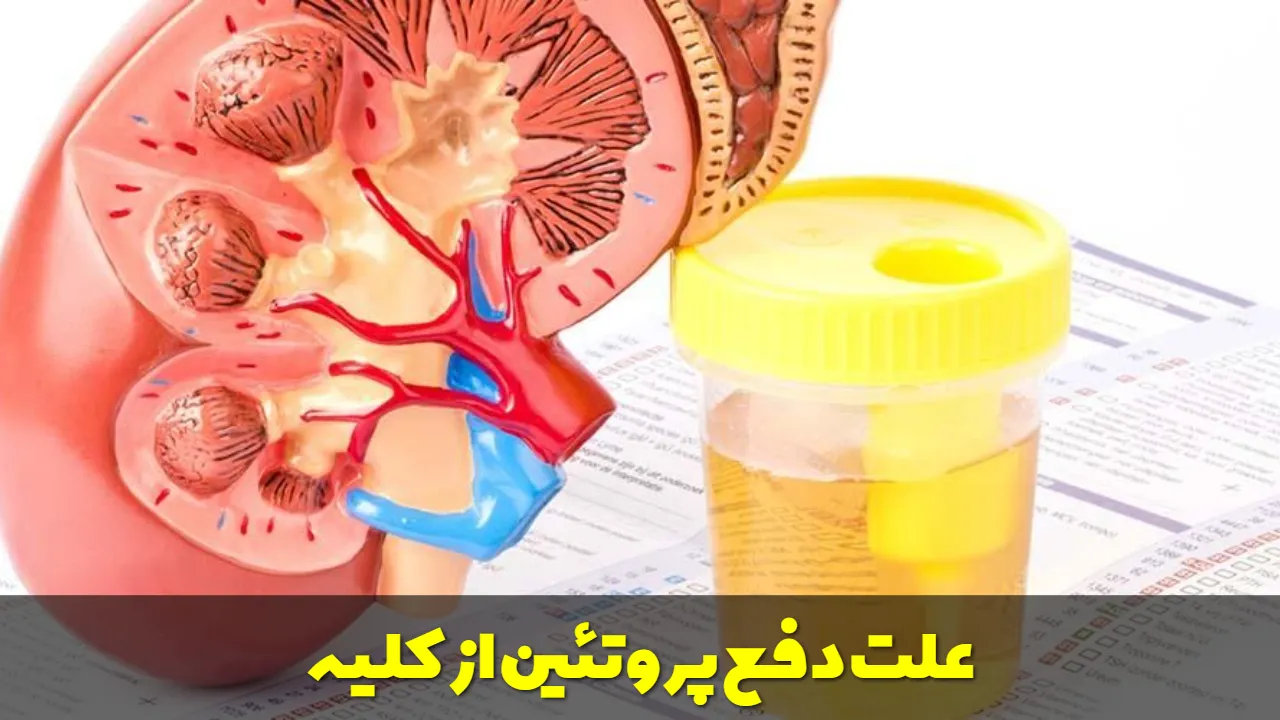 علت دفع پروتئین از کلیه