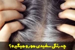 چه رنگی سفیدی مو رو میگیره؟