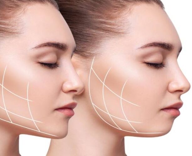انواع روش های ساده زاویه سازی و فرم دهی فک و صورت در خانه