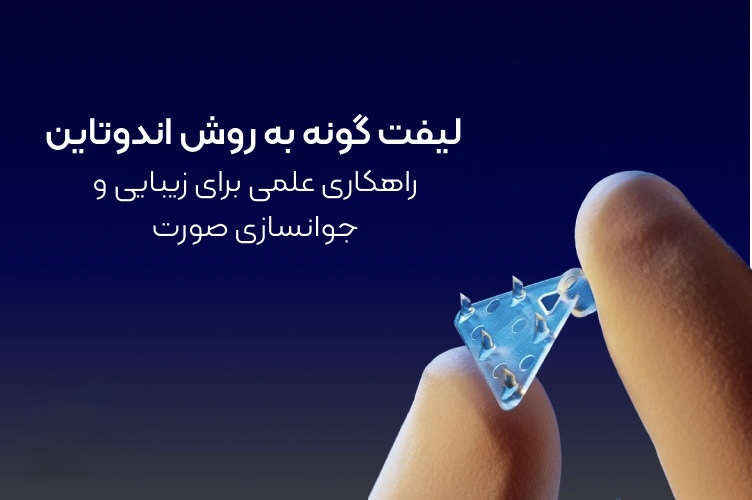 لیفت اندوتاین
