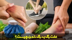 علت رگ به رگ شدن چیست؟
