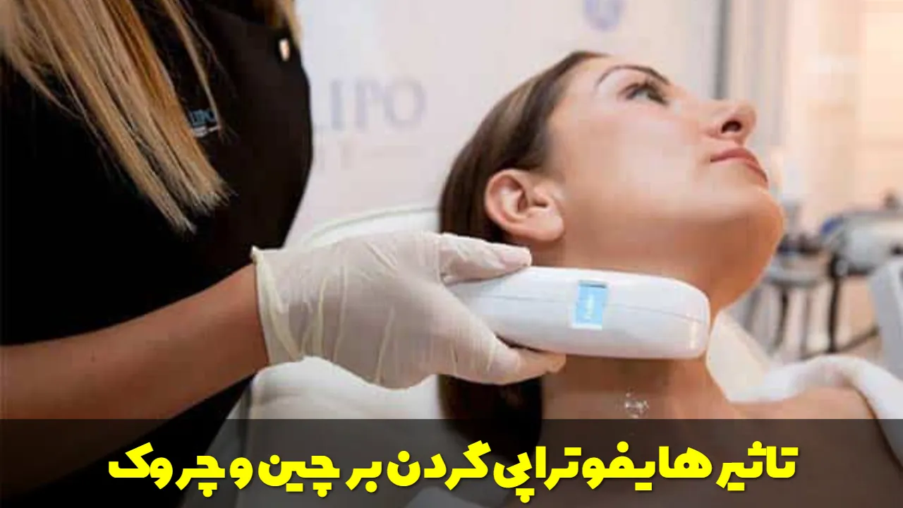 هایفوتراپی گردن