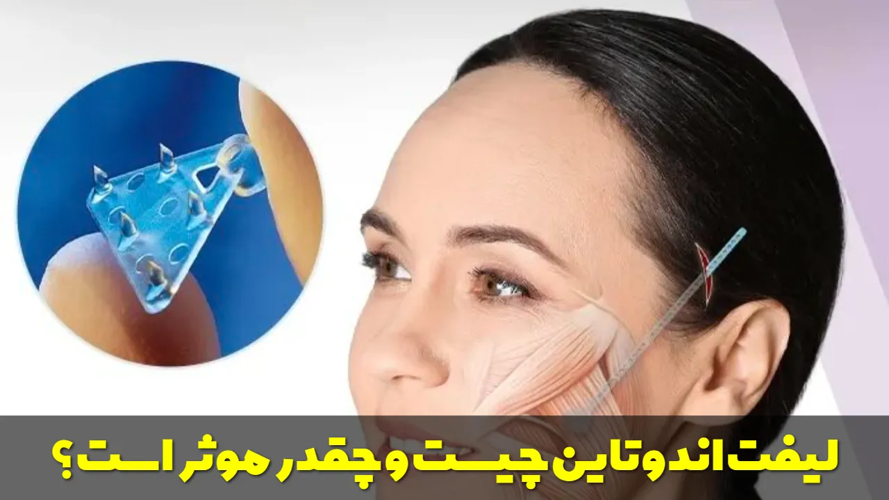 لیفت اندوتاین چیست و چقدر موثر است؟