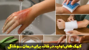 کمک های اولیه در خانه برای درمان سوختگی