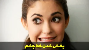 پخش شدن خط چشم