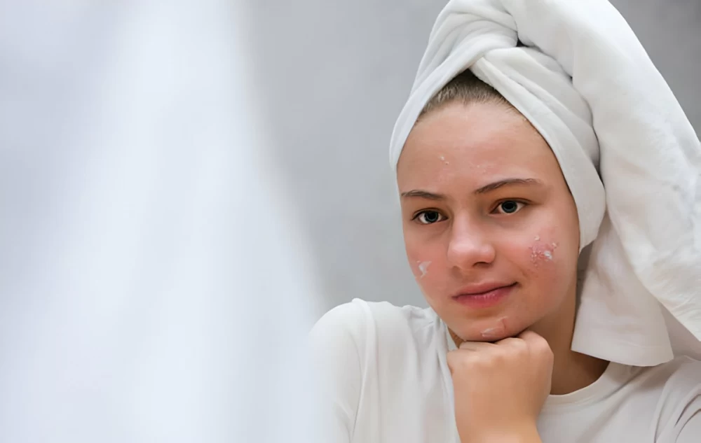 سوکسینیک اسید برای پوست