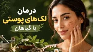 درمان لک های پوستی با گیاهان