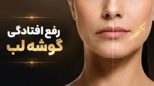 رفع افتادگی گوشه لب