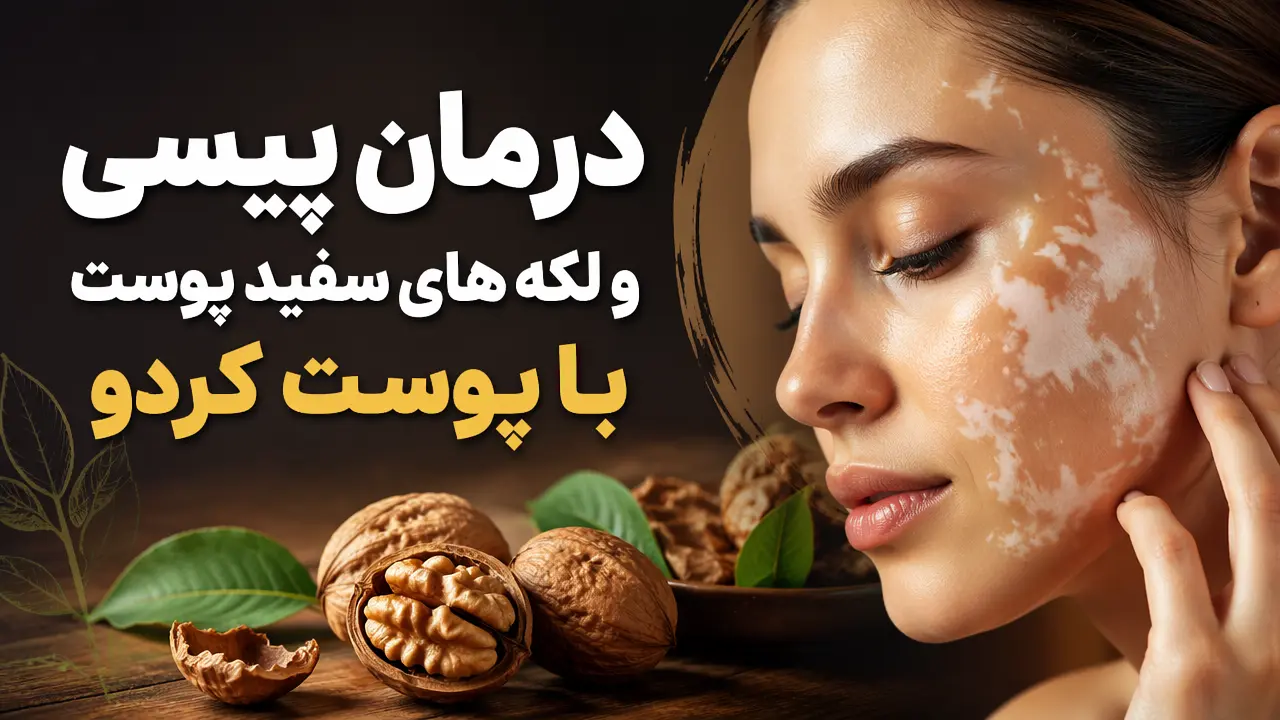 درمان پیسی و لکه های سفید پوست با پوست گردو