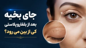 جای بخیه بعد از بلفاروپلاستی کی از بین می رود؟