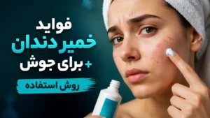 فواید خمیر دندان برای جوش + روش استفاده