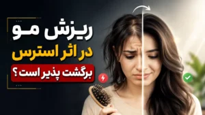 ریزش مو در اثر استرس برگشت پذیر است؟