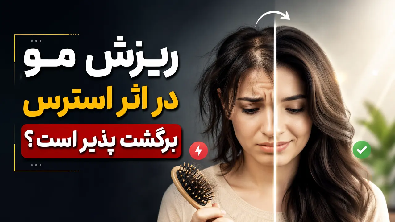 ریزش مو در اثر استرس برگشت پذیر است؟