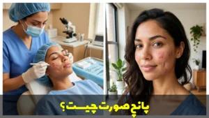پانچ صورت چیست