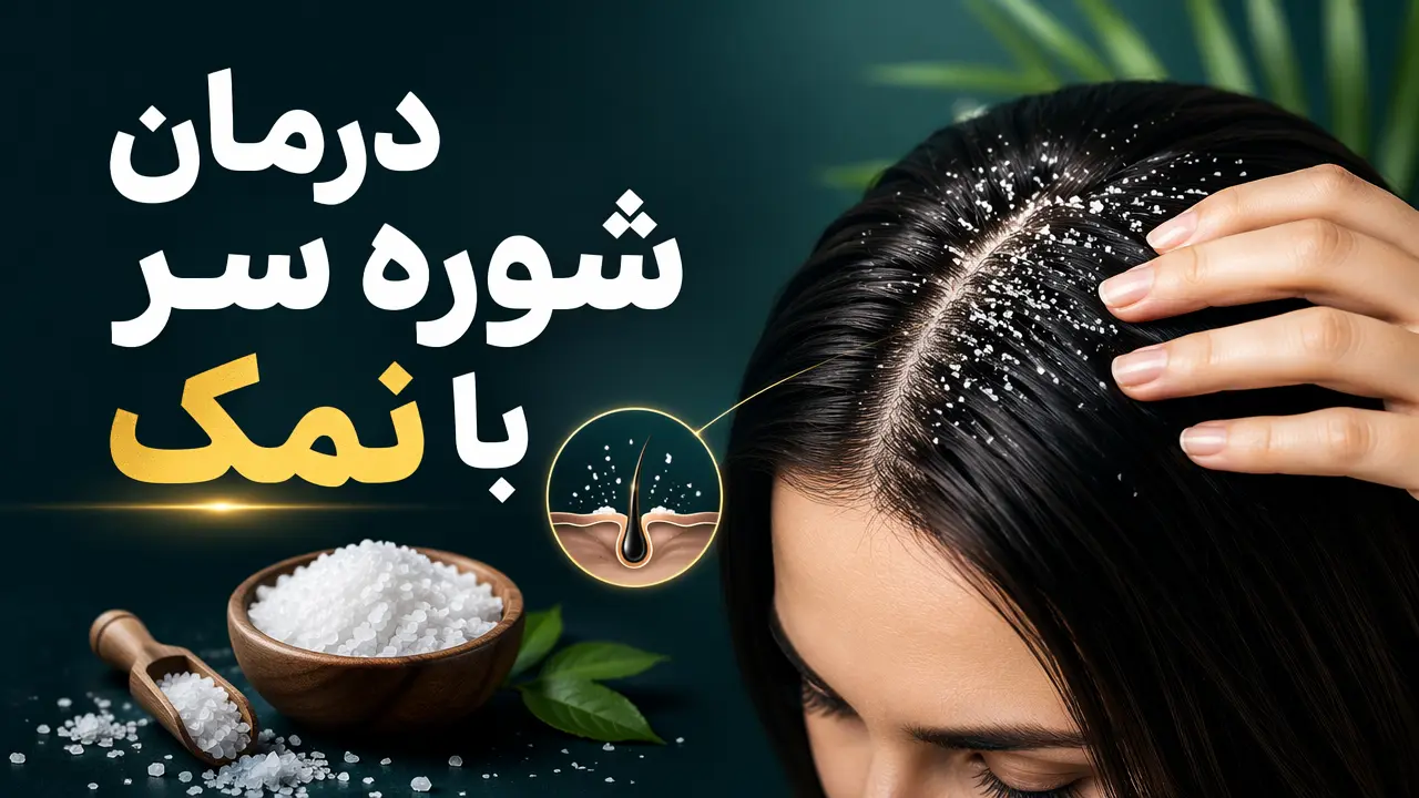 درمان شوره سر با نمک