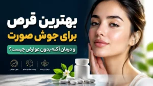 بهترین قرص برای جوش صورت و درمان آکنه بدون عوارض چیست؟
