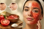 چگونه با ماسک گوجه و شکر لکه های تیره پوست را از بین ببریم؟