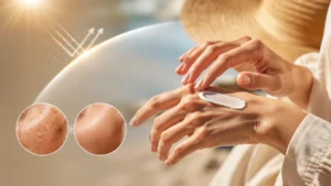 ضد آفتاب برای دست جهت جلوگیری از پیری و لک دست چی خوبه؟