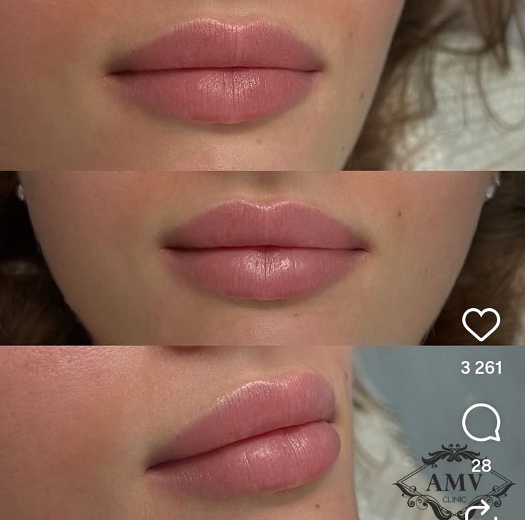مدل ژل لب روسی