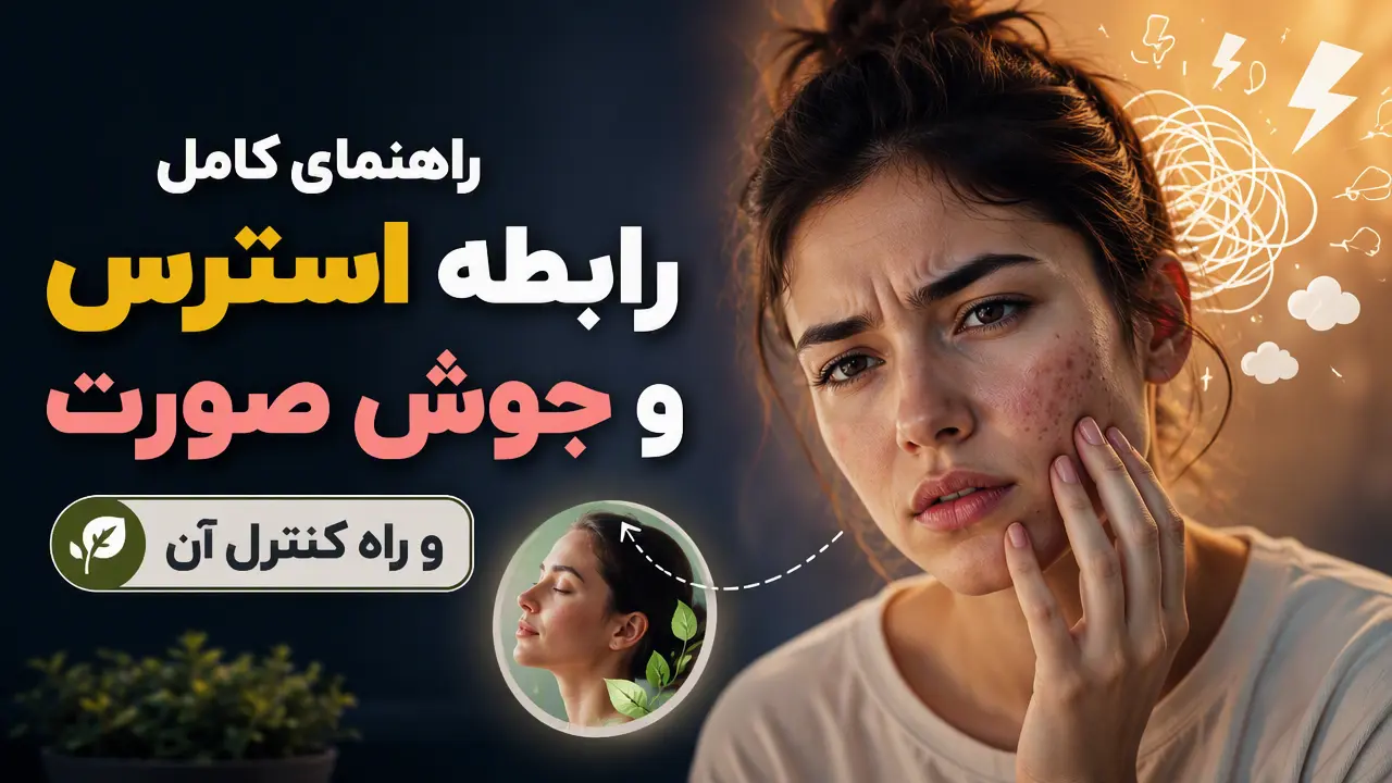 راهنمای کامل رابطه استرس و جوش صورت و راه کنترل آن