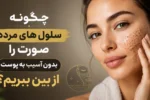 چگونه سلول های مرده صورت را بدون آسیب به پوست از بین ببریم؟