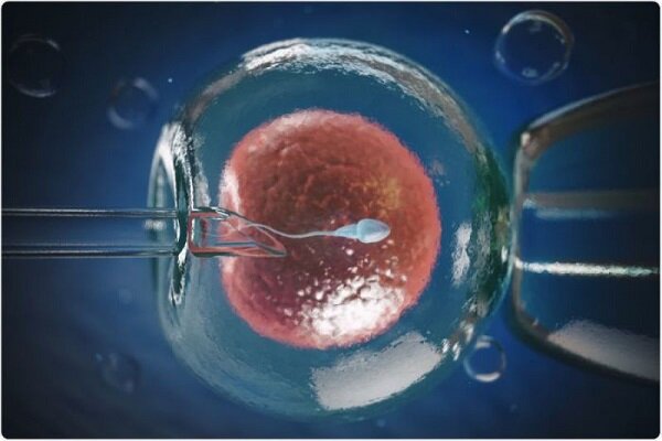 عوامل موثر بر استفاده از تخمک فریز شده