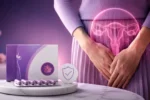 کپسول لاکتوفم برای چی خوبه؟ طریقه مصرف کپسول لاکتوفم برای عفونت واژن