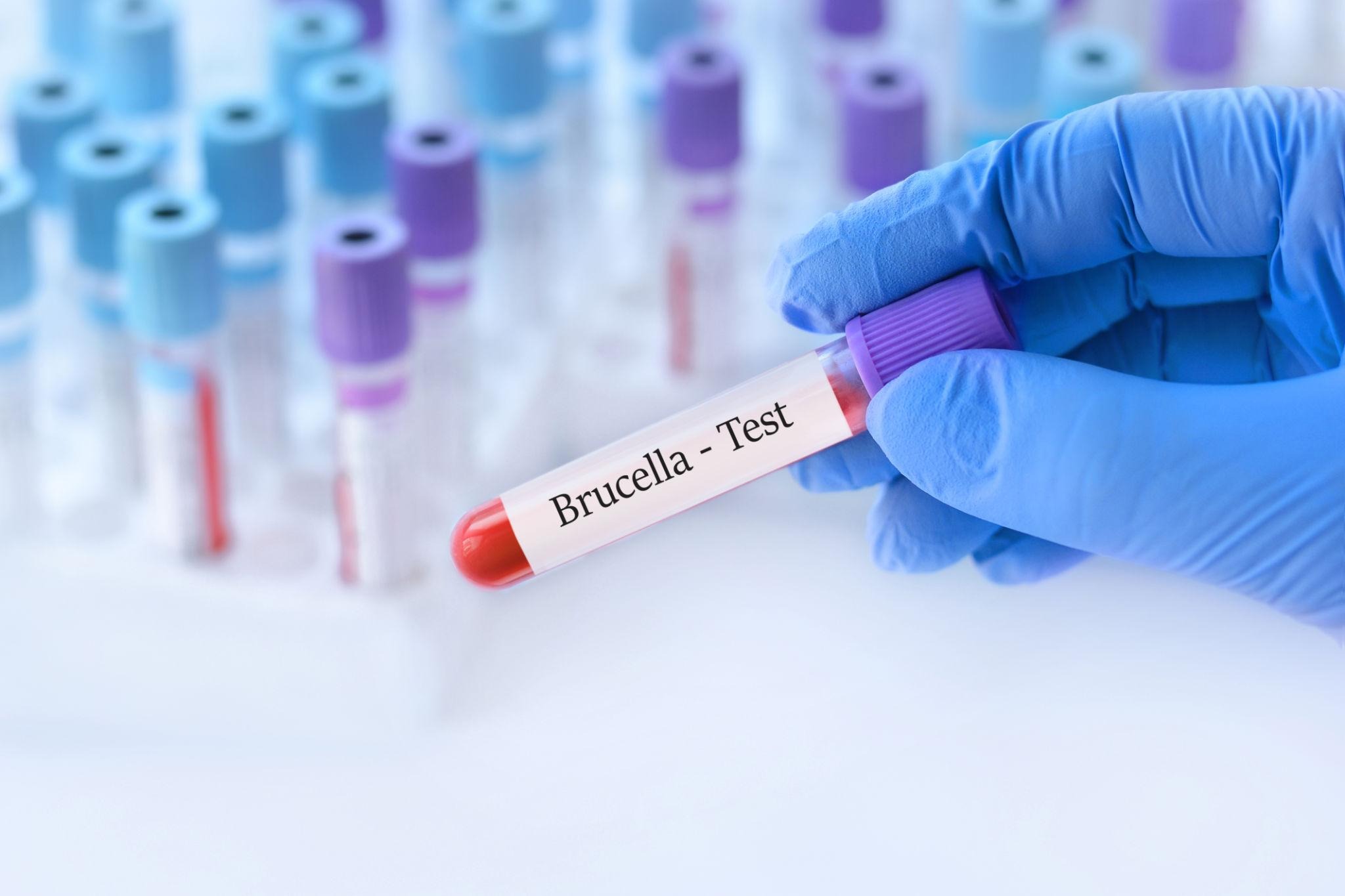 از کجا بفهمم تب مالت دارم؟