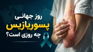 روز جهانی پسوریازیس چه روزی است؟