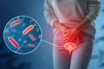 عفونت ادراری در زنان؛ علائم، علل و راه های پیشگیری