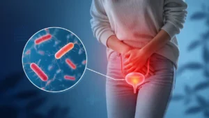 عفونت ادراری در زنان؛ علائم، علل و راه های پیشگیری
